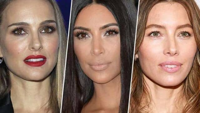 Rhinoplastie star