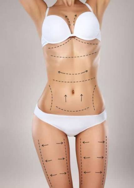 Zoom sur les zones traiter avec la liposuccion | Idealmed