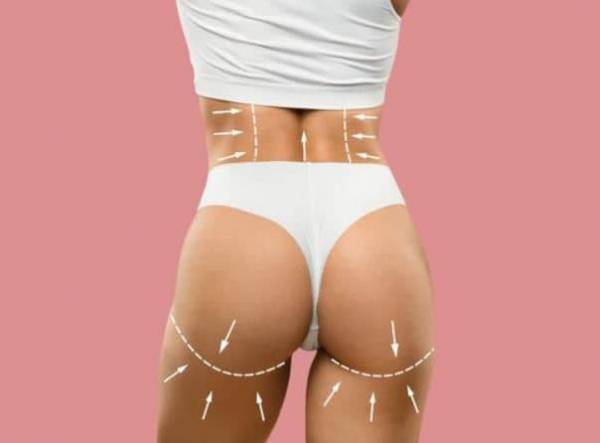 Lipofilling fessier apres 10 ans : voici à quoi s’attendre | Idealmed