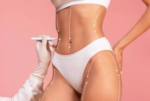 Quand Voit-on les résultats d'une liposuccion ?