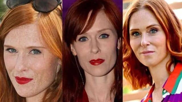 Analyse avant-après : Audrey Fleurot chirurgie esthétique révélée