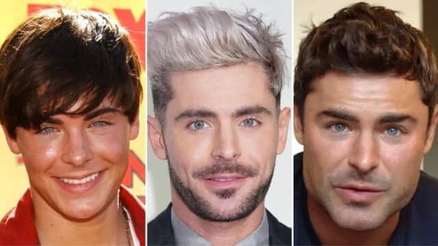 Zoom sur les Zac Efron chirurgie esthétique