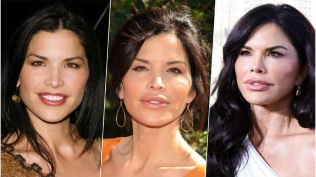 Rachida Dati chirurgie esthétique 2025