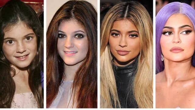Kylie Jenner chirurgie esthétique : vérités ou rumeurs ?