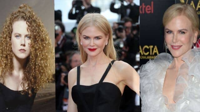 Nicole Kidman chirurgie esthétique : vérités ou rumeurs ?