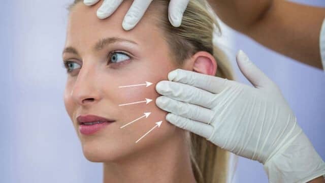 Prix lifting cervico-facial Tunisie en 2025 pas cher