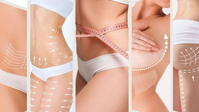 Liposuccion Tunisie 2025 : guide complet et prix abordables