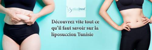Tout ce qu’il faut savoir sur la liposuccion en Tunisie