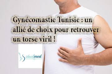 Gynécomastie : Tout ce qu'il faut savoir