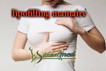Lipofilling seins : faut-il se lancer sans hésiter ?