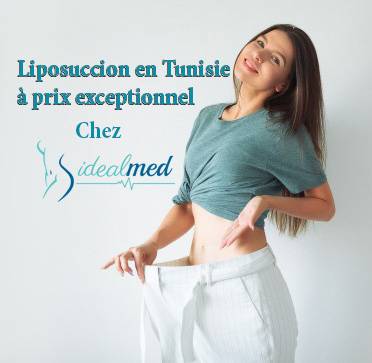 Pourquoi opter pour une liposuccion Tunisie ?
