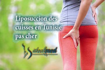 Quand faire une liposuccion des cuisses en Tunisie ?
