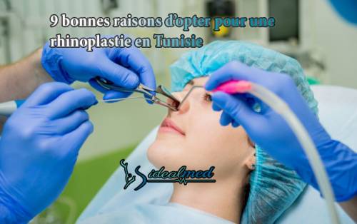 9 bonnes raisons d’opter pour une rhinoplastie en Tunisie