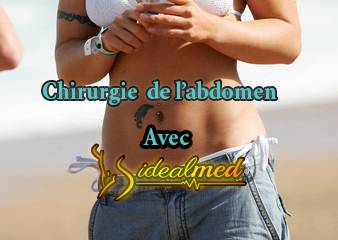 8 points à savoir avant une abdominoplastie